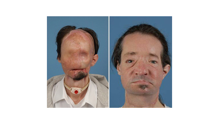 Dallas Wiens before and after pictures