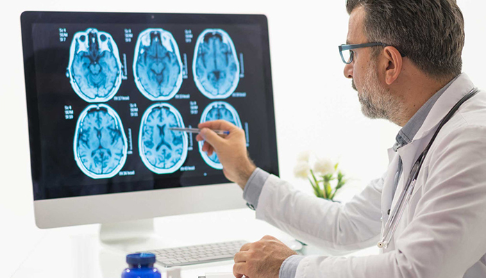 Medical provider looking at brain scans