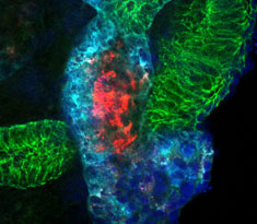 Mini-kidneys created from stem cells used to study diseases of glomerulus and Polycystic Kidney Disease (PKD)