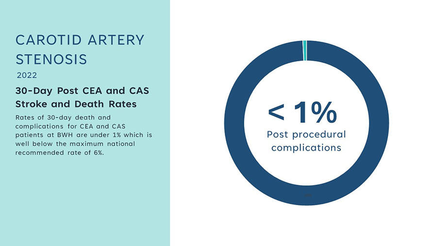 Carotid Complication Rate graphic showing fewer than 1 percent post-procedural complications