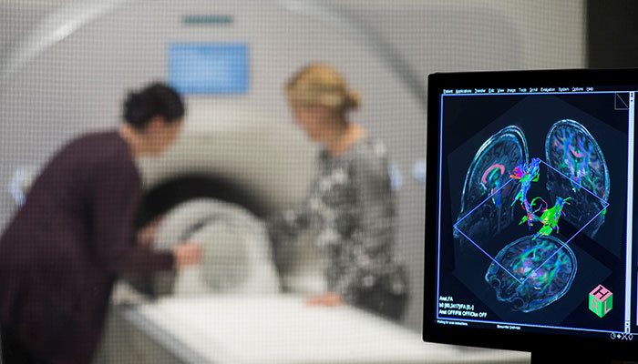 7 Tesla (7T) magnetic resonance imaging (MRI) scanner