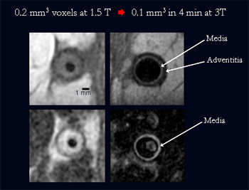 Inner-volume 3D MRI