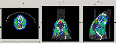 PET/CT images of glioma in a mouse using 18F-FLT.