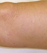 Bwh Medical Records Bwh Medical Records