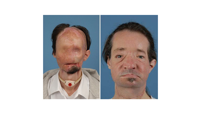 Dallas Wiens before and after pictures
